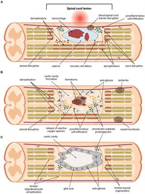 The role of small extracellular vesicles and microRNA as their cargo in the spinal cord injury pathophysiology and therapy